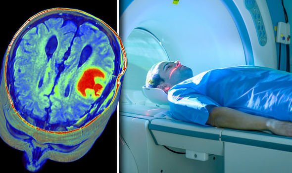 Researchers May Have Discovered 2 Tests Which Could Help Physicians Treat Autism